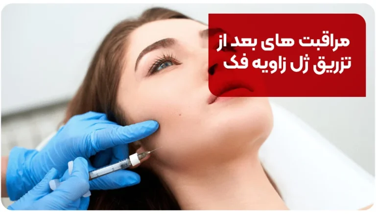 مراقبت های بعد از تزریق ژل زاویه فک