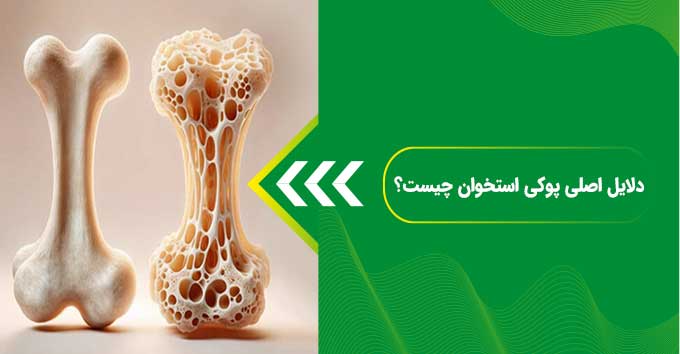 پودر جوانه گندم برای تقویت استخوان ها و مقابله با پوکی استخوان