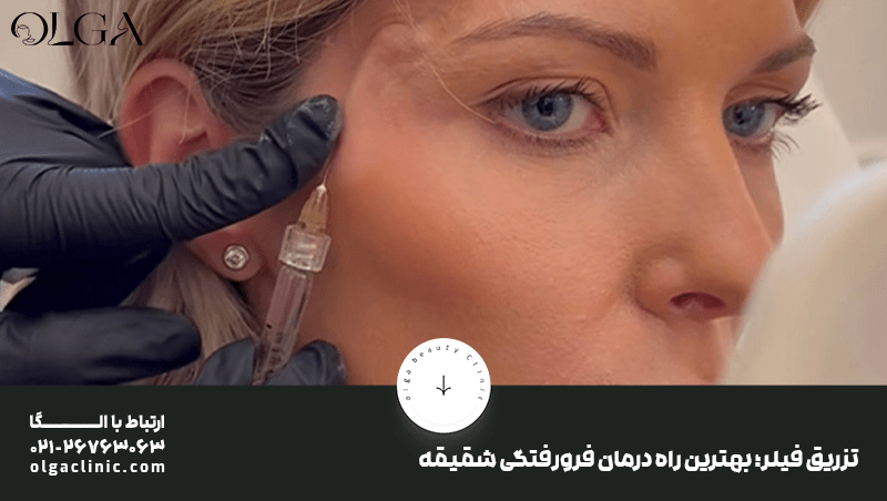 درمان | جراحی موثرترین راه درمان فرورفتگی شقیقه