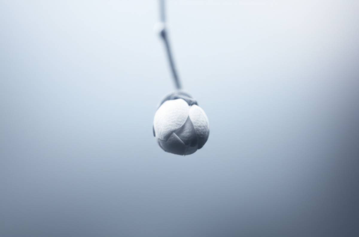 جنین | وکیل جنین ۵ ماهه سقط شده: راهنمای کامل دلایل، علائم و مراقبتها